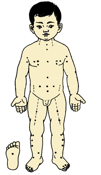 ����Ѩλ��ͼ