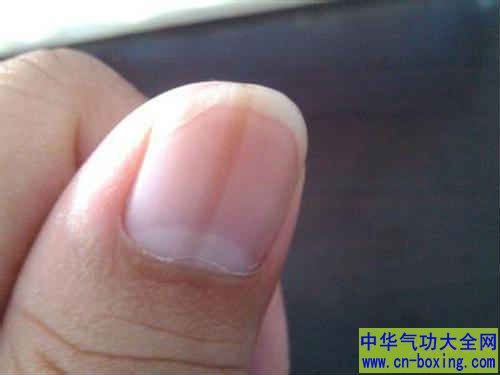 ���ͨ��ָ�׼����Լ�������״��